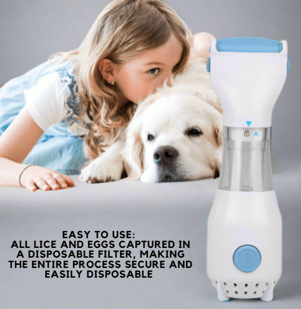 Electric Lice Comb for Fleas, Dandruff, Lice + Eggs, Crab Louse & Body Louse